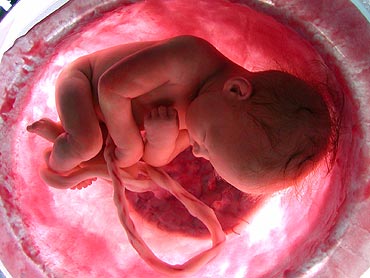 fetoscopia 13 Segundos: un aborto de película, mano